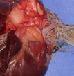 Heartworm Disease